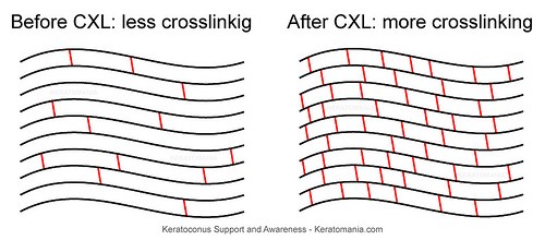 c3r-surgery-cost.jpg