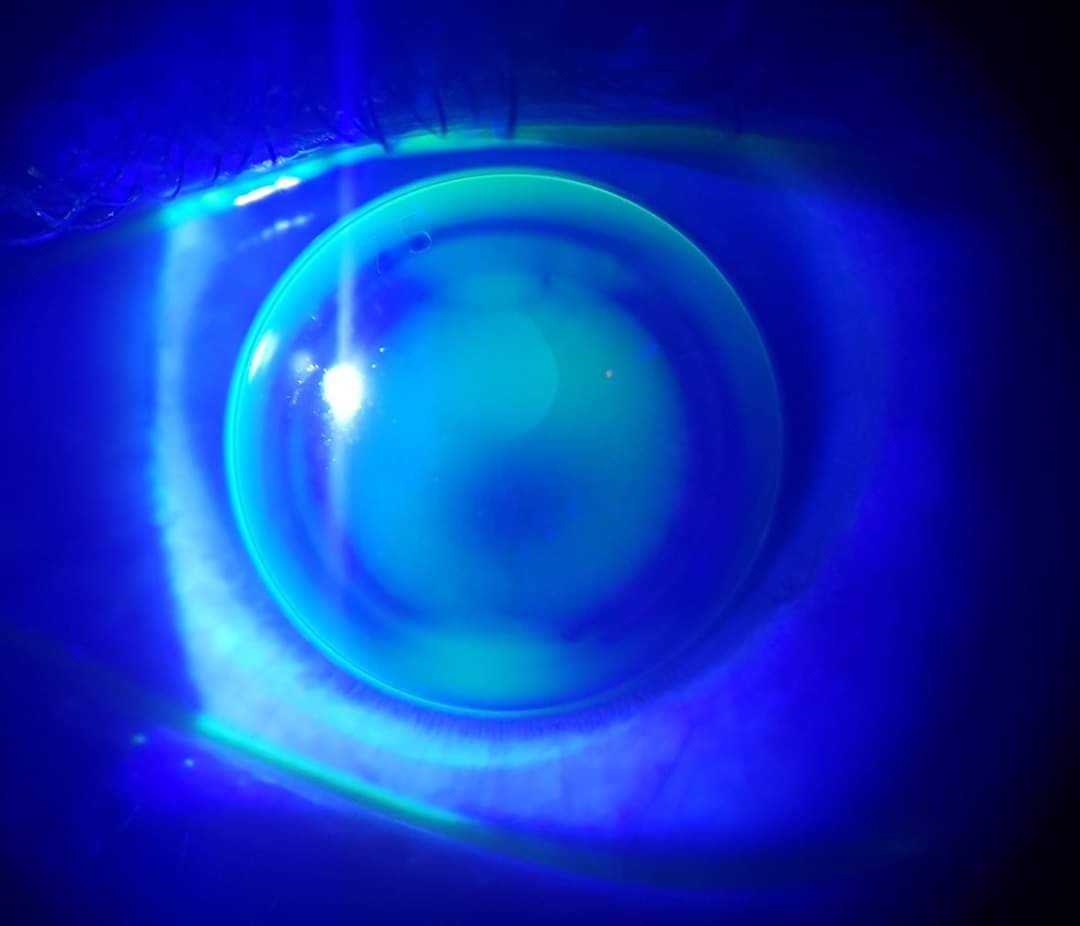 rose-k-lenses