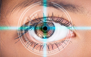 lasik-surgery