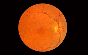 retina
